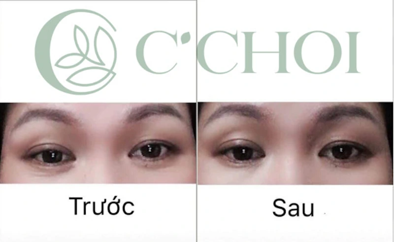 Review Tinh Chất Dưỡng Mắt C’choi 3 Tác động - Triple Effect Eye Serum